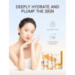 VC Peel 5-Piece Set