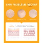 VC Peel 5-Piece Set